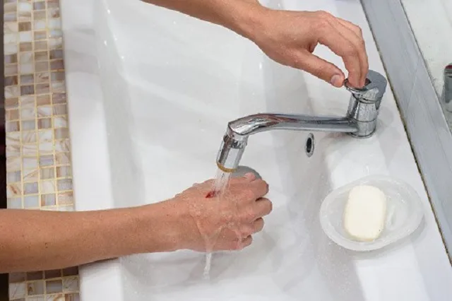 sơ cứu khi bị bỏng bô xe máy