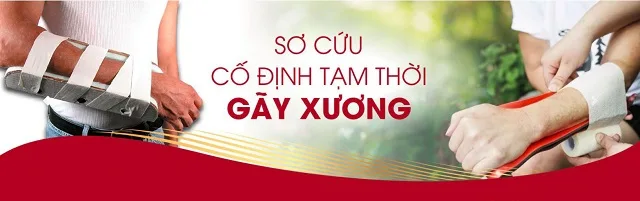 sơ cứu cố định xương tạm thời sơ cứu cố định xương tạm thời