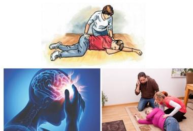 hướng dẫn sơ cứu đột quỵ