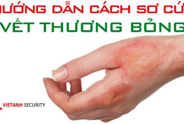 sơ cứu bỏng