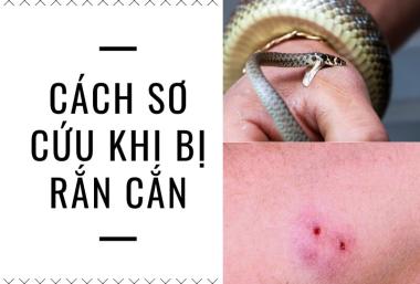 Sơ cứu khi bị rắn cắn